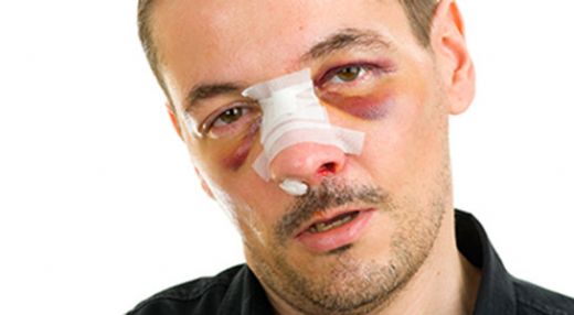 Ameliyat Sonrası Şişlik Riskleri ve Sonrası