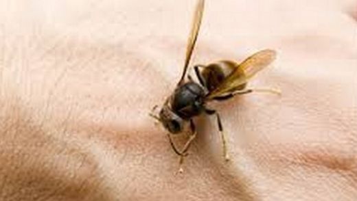 Arı Sokması Şişliği Nasıl İner?