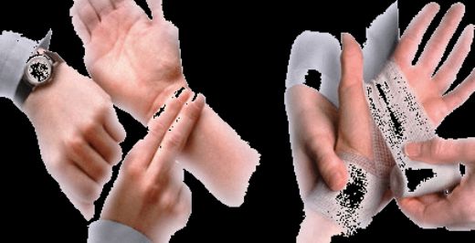 Bilek Burkulması Şişlik Nedenleri?