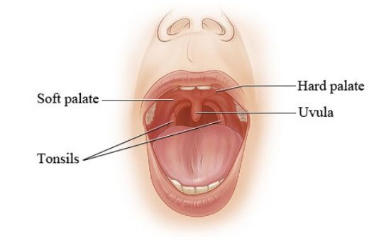 Damakta Sivilce Gibi Şişlik Belirtileri ve Tedavisi