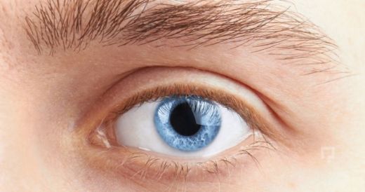 Göz Kapağı Şişliği Belirtileri ve Tedavisi