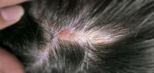 Kafada Oluşan Şişlik Nedenleri?