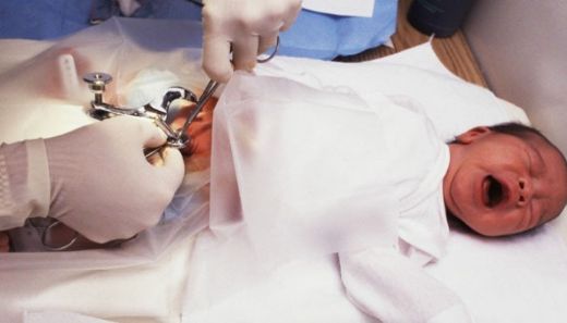 Sünnet Sonrası Şişlik Nedenleri